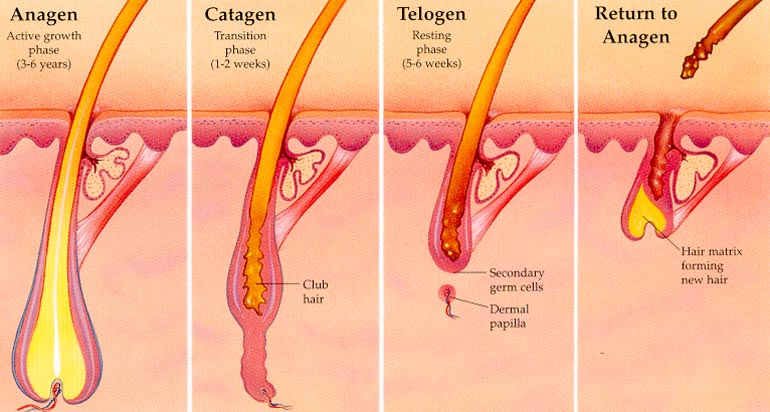 Electrolysis